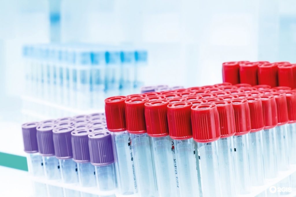 ЛАБОРАТОРИЯ INVITRO: качество, точность и быстрота исследований ufD9J oNKeU 1024x682 - ЛАБОРАТОРИЯ INVITRO: качество, точность и быстрота исследований